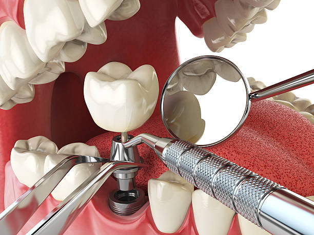 Best Emergency Broken Tooth Repair in Greenfields, PA